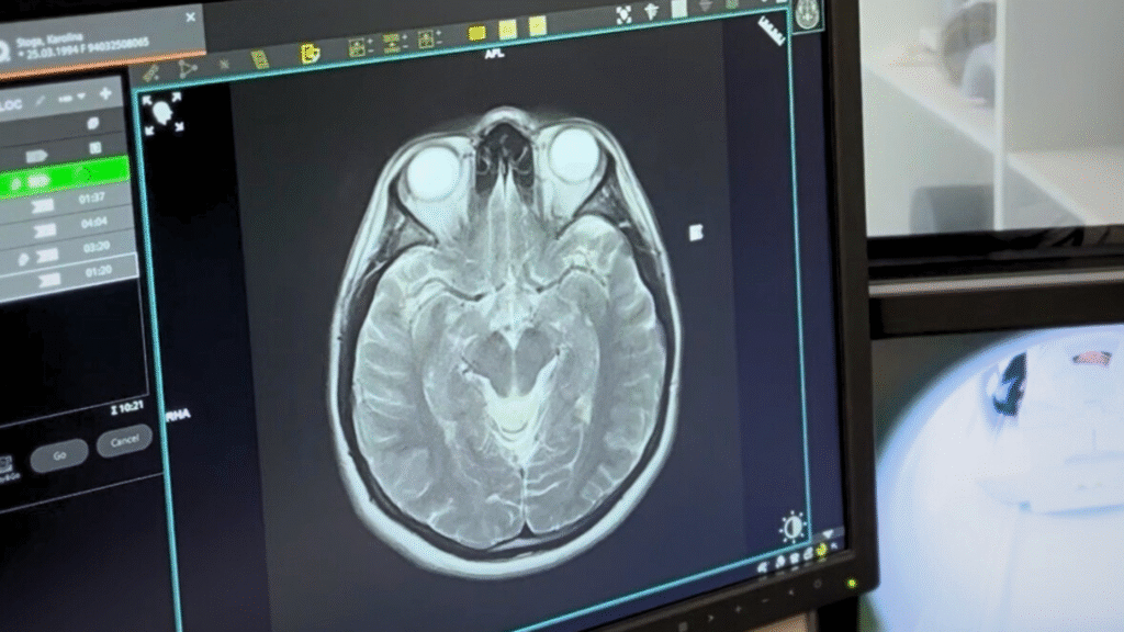 Twój świat w obrazie! Europejski Dzień Mózgu