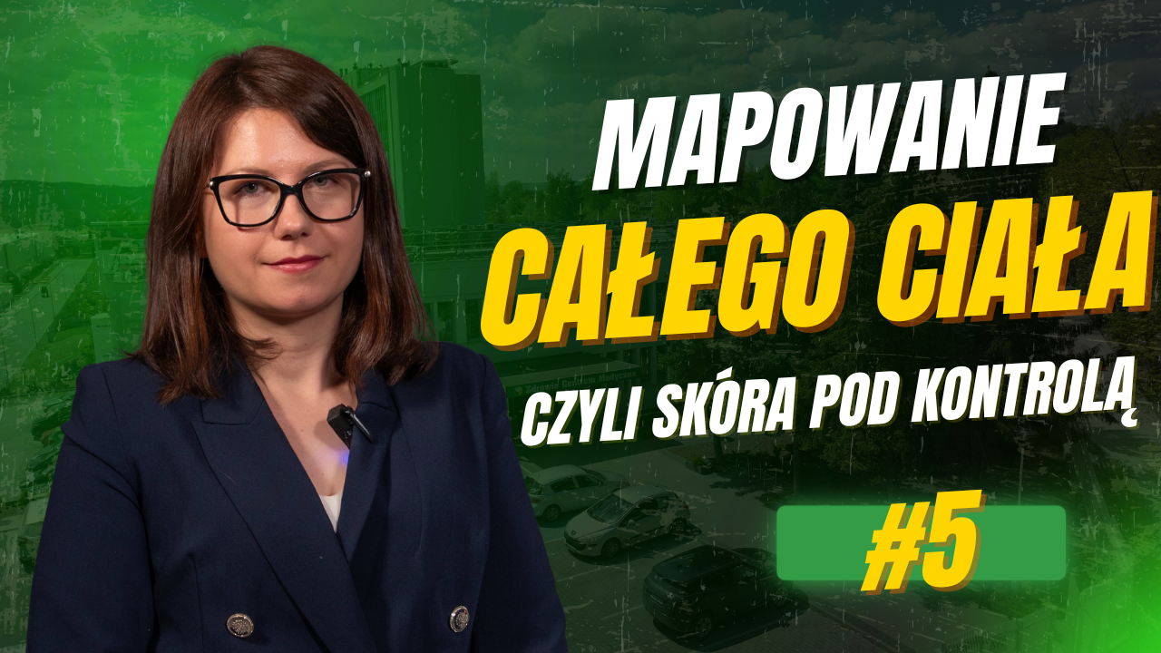 Podcast #5: Masz pieprzyki? To badanie może wykryć coś, zanim będzie za późno