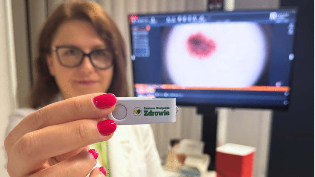 Przedłużamy wakacyjną promocję! Zmapuj całe ciało i sprawdź znamiona – 450 zł zamiast 950 zł.